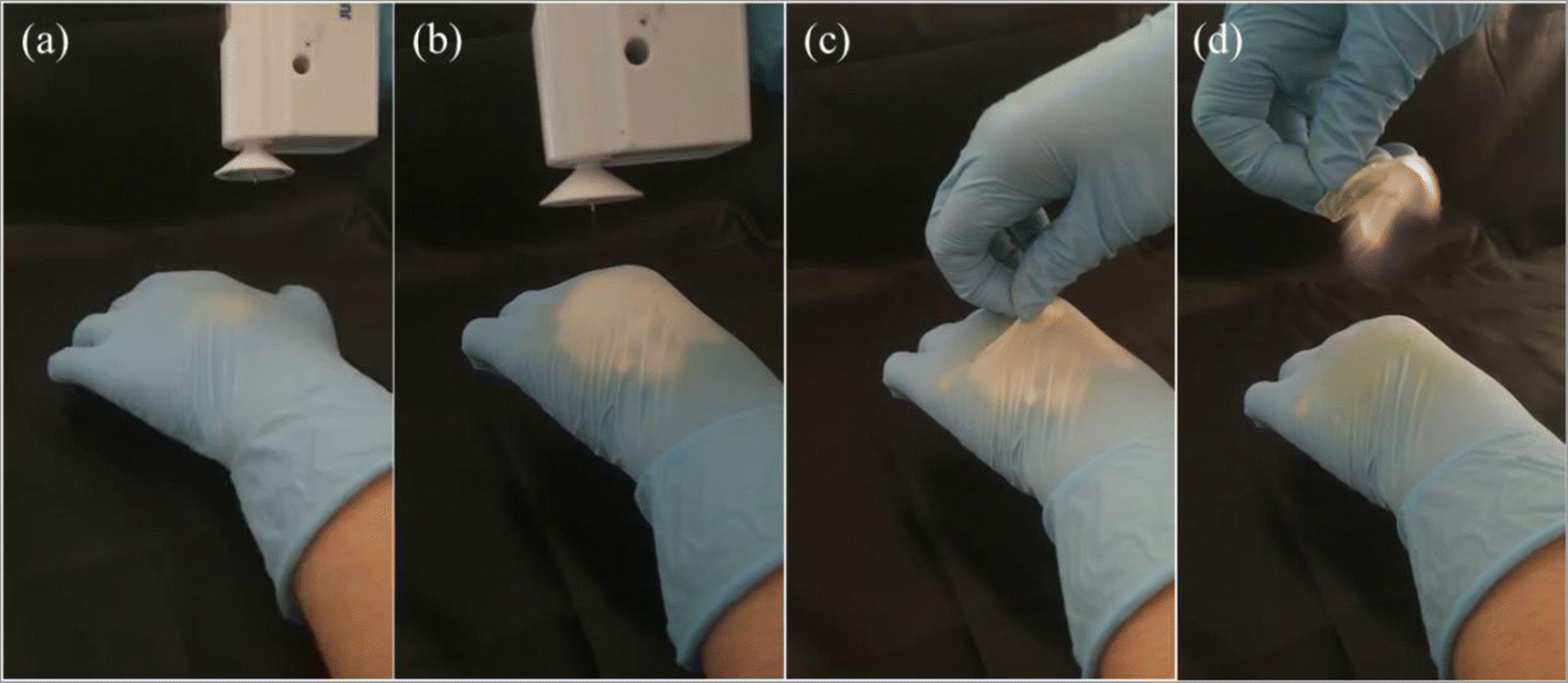 In Situ Electrospinning IodineBased Fibrous Meshes for Antibacterial