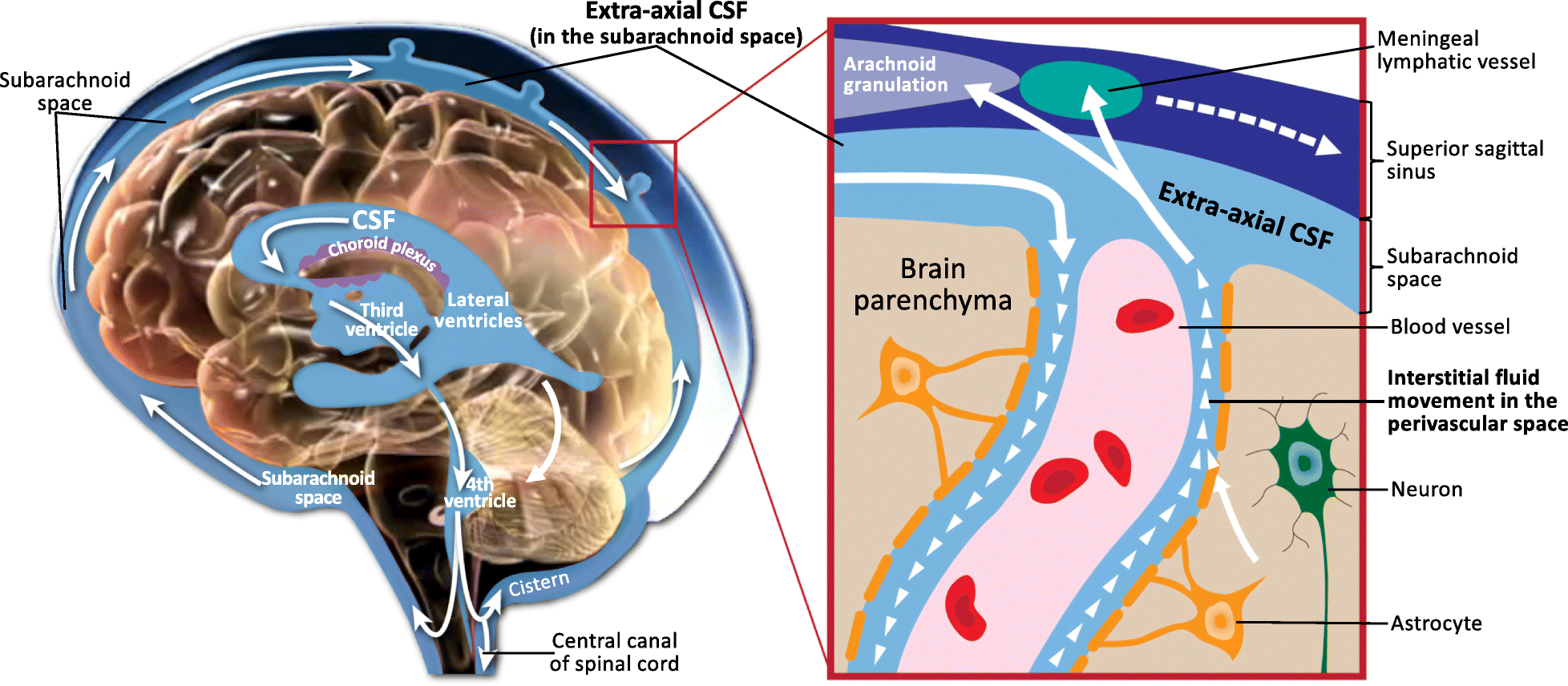 Excess Brain Fluid May Forecast Autism >> Cerebrospinal Fluid And The Early Brain Development Of Autism Excess Brain Fluid May Forecast Autism >> Cerebrospinal Fluid And The Early Brain Development Of Autism