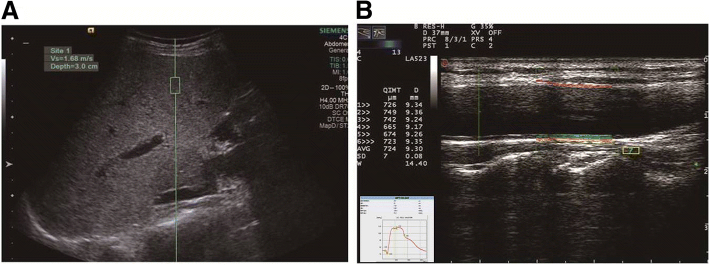 Ultrasonic Assessment Of Liver Stiffness And Carotid Artery