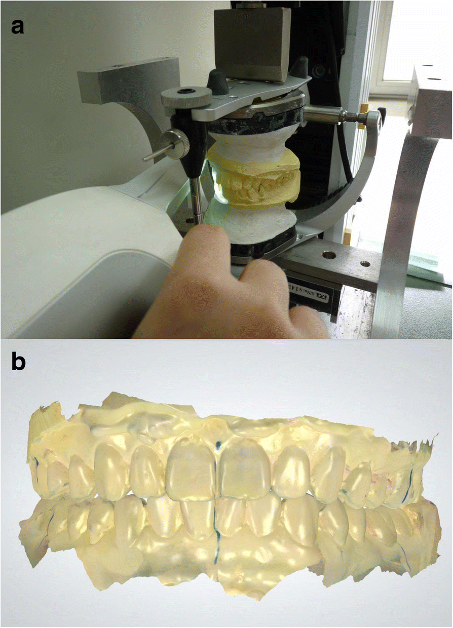 Comparison Of The Occlusal Contact Area Of Virtual Models And