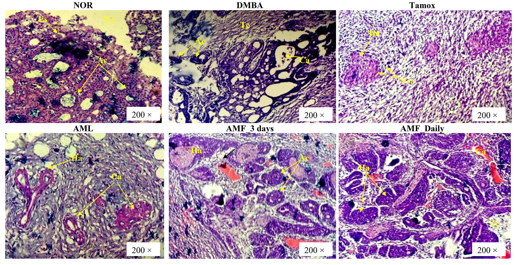 Comparative anticancer effects of Annona muricata Linn (Annonaceae) leaves  and fruits on DMBA-induced breast cancer in female rats | springermedizin.de