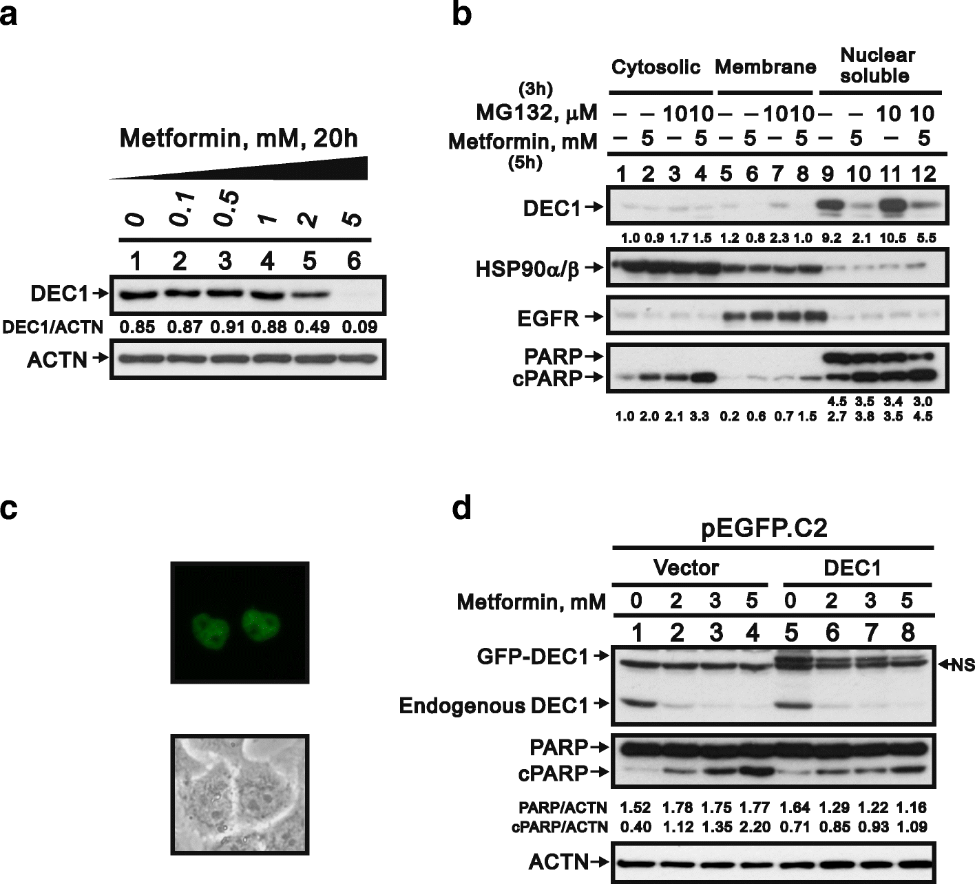 Metformin Causes Cancer Cell Death Through Downregulation Of