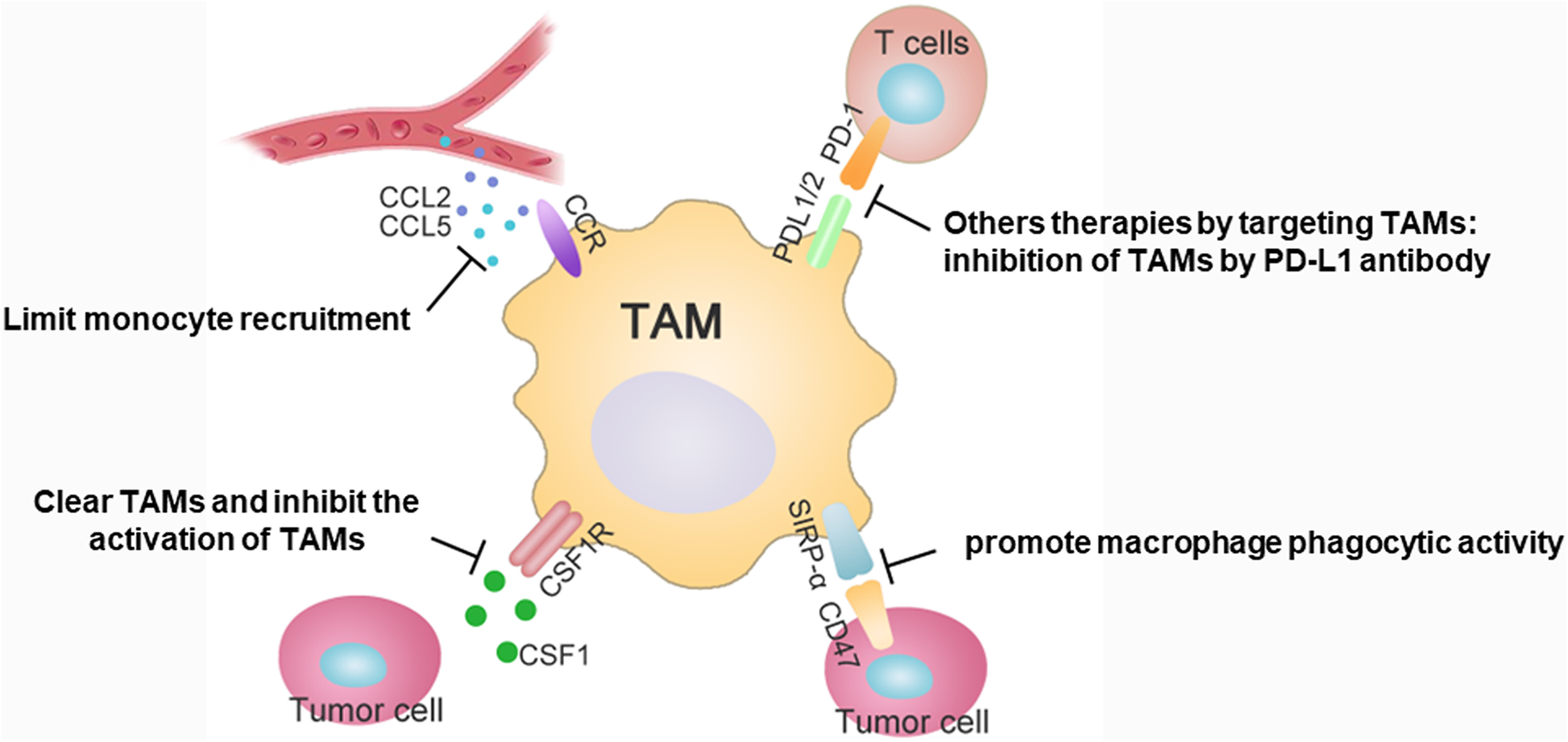 Tumorassociated macrophages an in solid tumor progression