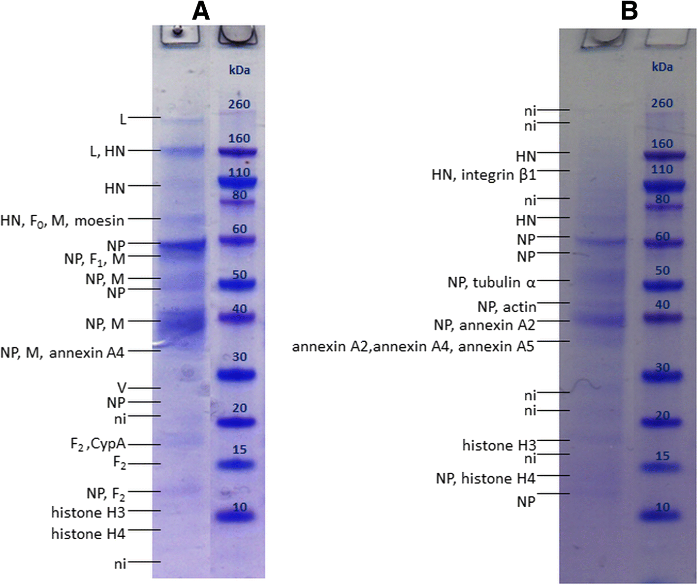 Mass Spectrometry Based Investigation Of Measles And Mumps