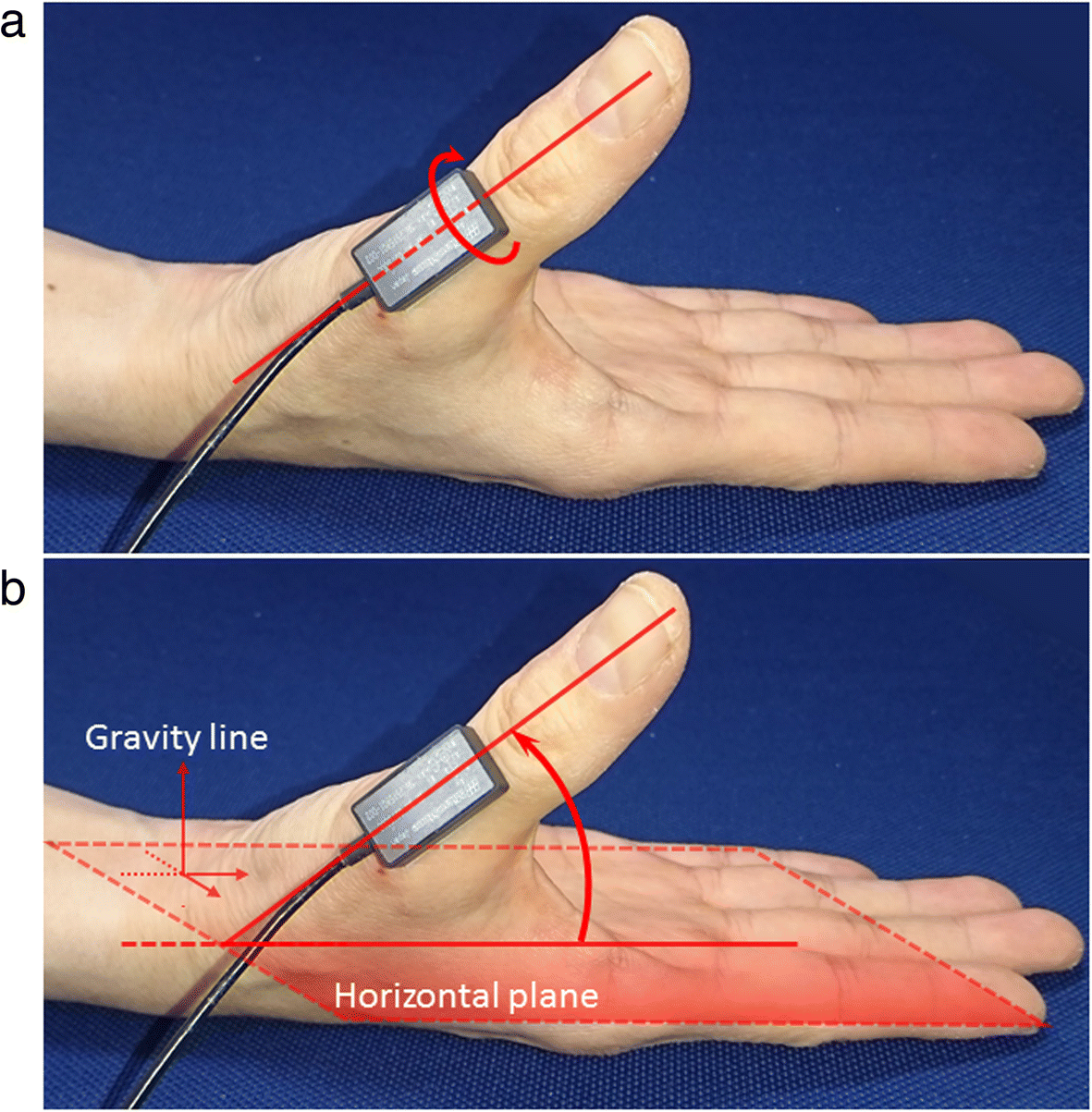 a-new-method-of-measuring-the-thumb-pronation-and-palmar-abduction-angles-during-opposition