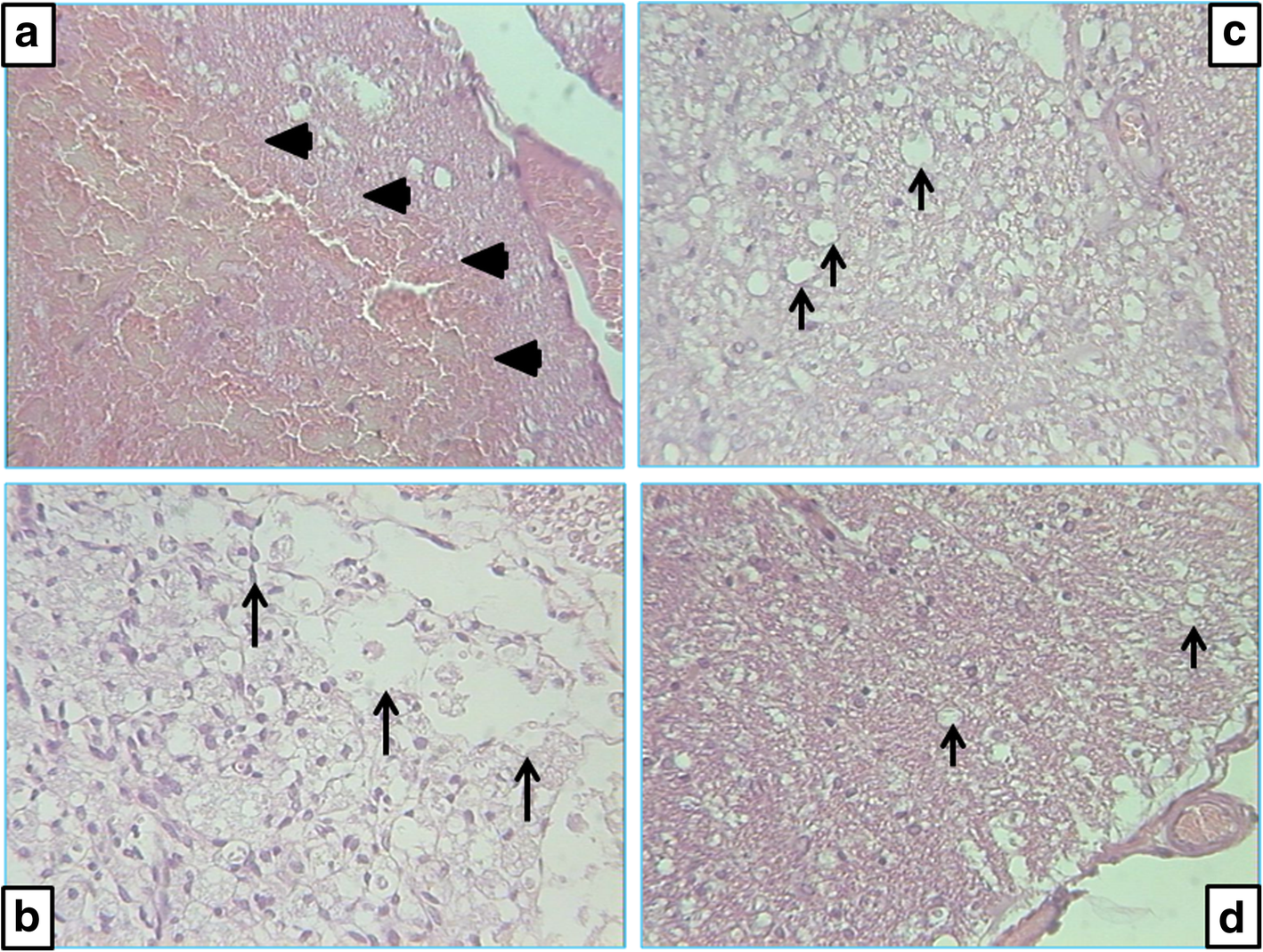 Stable gastric pentadecapeptide BPC 157 can improve the healing course of  spinal cord injury and lead to functional recovery in rats