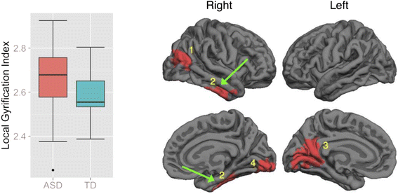 In Autism Brain Shows Unusual Thinning >> Cortical Morphological Markers In Children With Autism A Structural In Autism Brain Shows Unusual Thinning >> Cortical Morphological Markers In Children With Autism A Structural