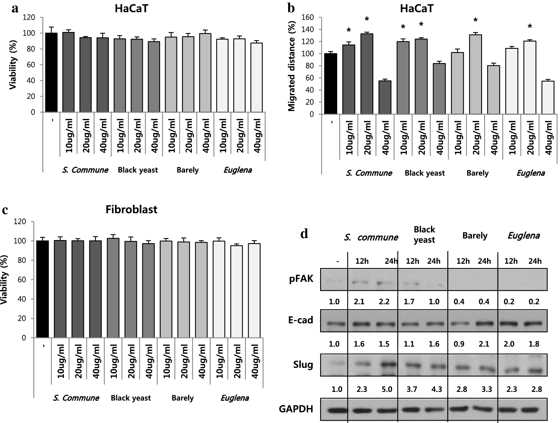 The wound healing effect of four types of betaglucan SpringerLink