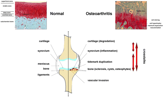 Basic Science Of Osteoarthritis | SpringerLink