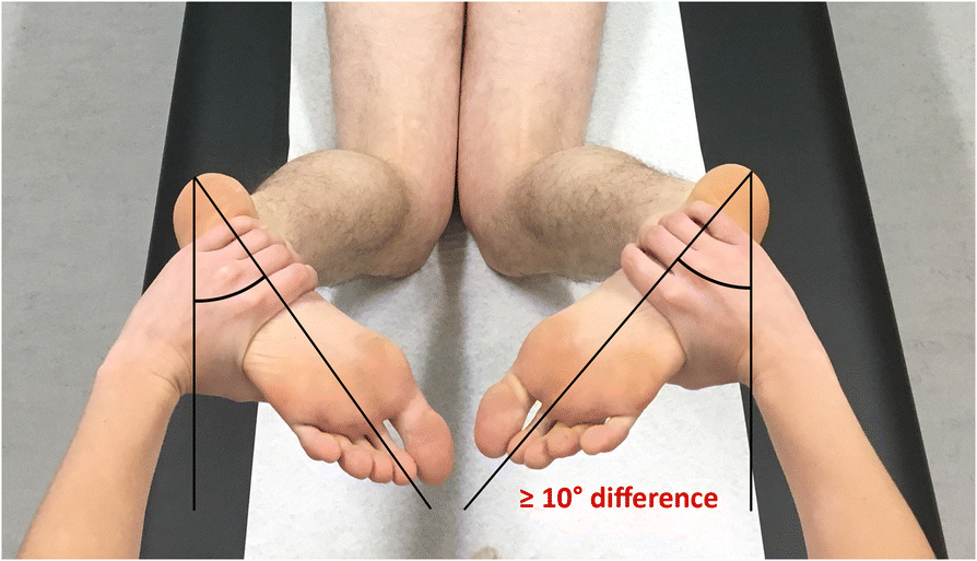 A Novel Test For Assessment Of Anterolateral Rotatory Instability