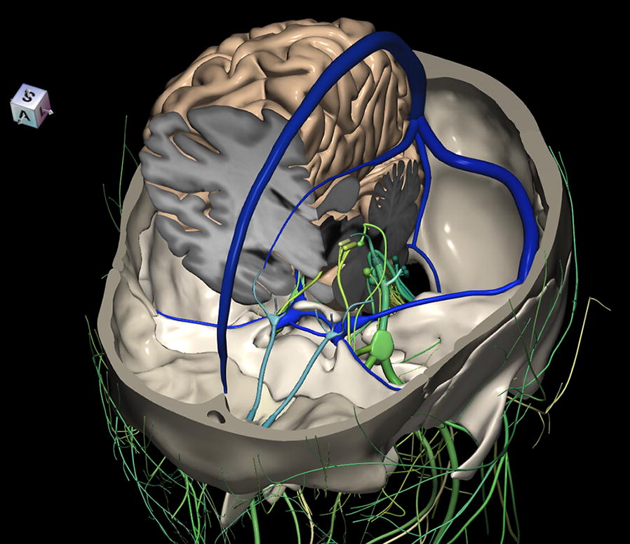 A 3d Stereotactic Atlas Of The Adult Human Skull Base