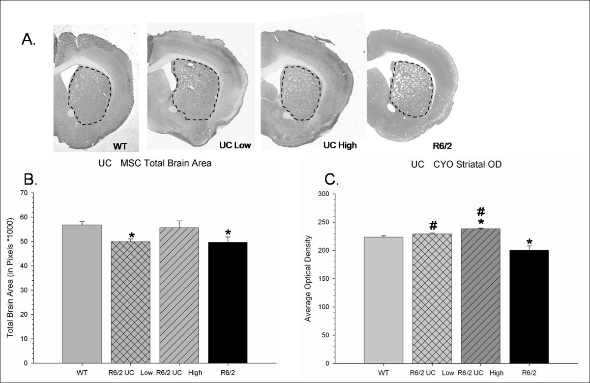 Transplantation Of Umbilical Cord Derived Mesenchymal Stem Cells Transplantation Of Umbilical Cord Derived Mesenchymal Stem Cells