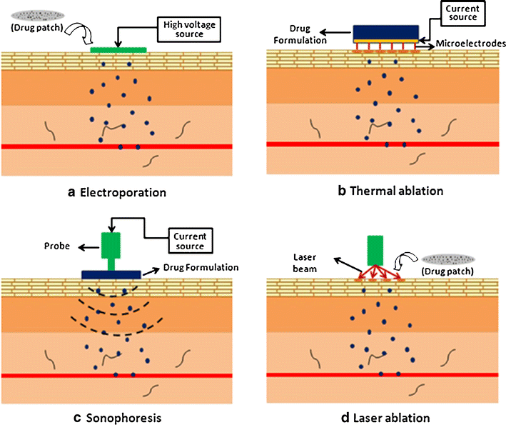Transdermal Delivery of Proteins | SpringerLink