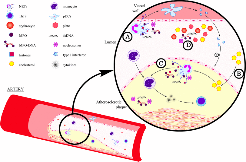 The Phenomenon of Neutrophil Extracellular Traps in Vascular Diseases ...