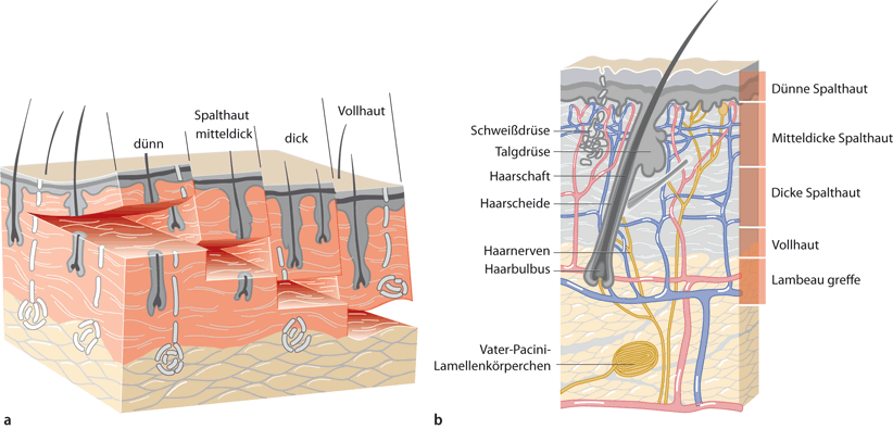 Spalthauttransplantation zur Weichteildefektdeckung | SpringerLink