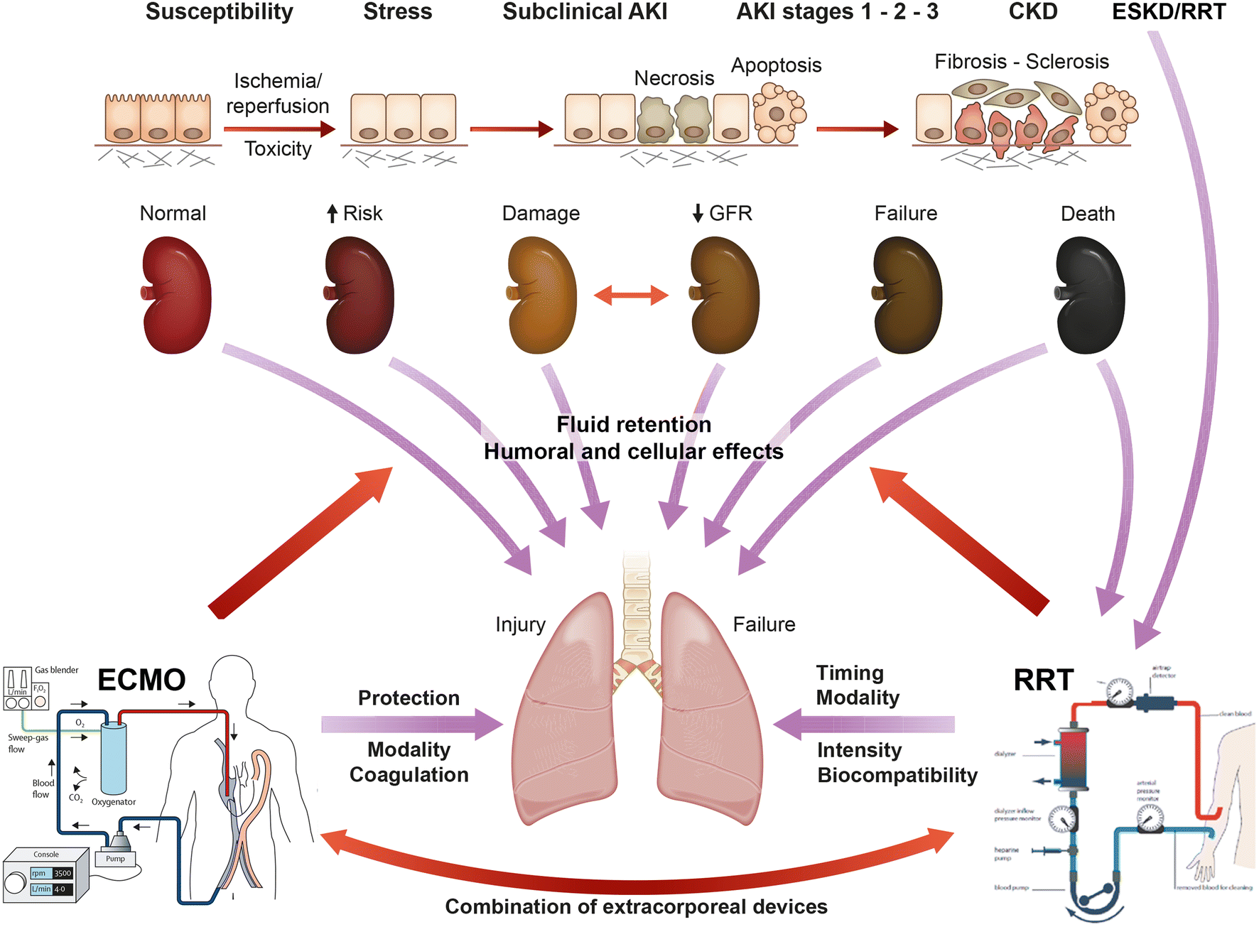 Lungkidney interactions in critically ill patients consensus report