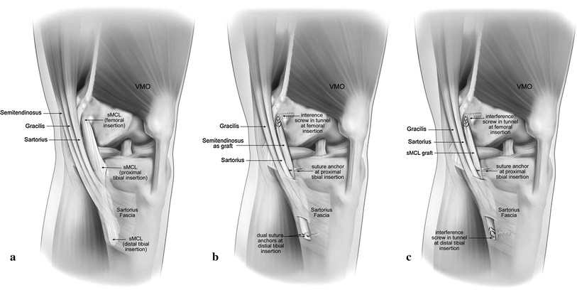 Knee Anatomy Google Scholar - Human Anatomy