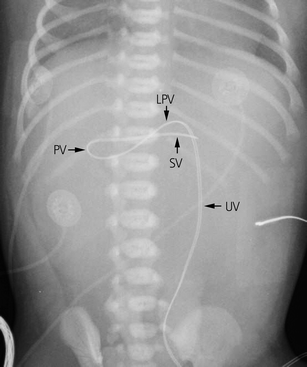 uvc placement uvc placement