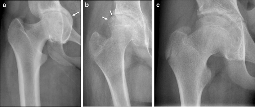 A Novel Radiographic Scoring System For Growth Abnormalities And 