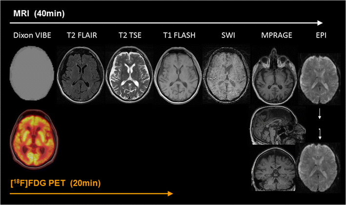 Current status and future role of brain PET/MRI in clinical and ...