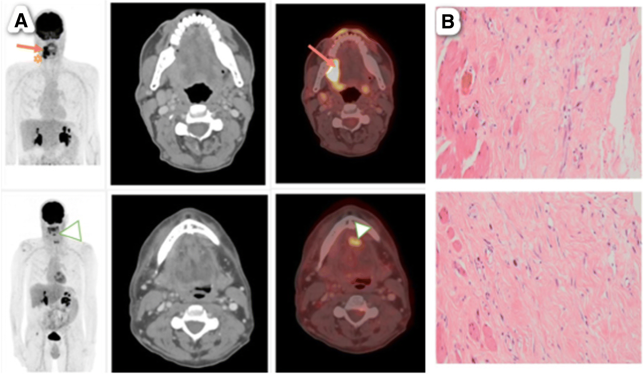 Can A Ct Scan Show Scar Tissue - ct scan machine