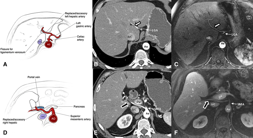 Liver Vascular Anatomy - Anatomy Diagram Book
