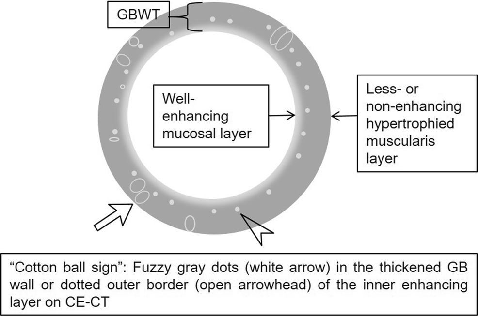 Correction to CT diagnosis of gallbladder adenomyomatosis importance