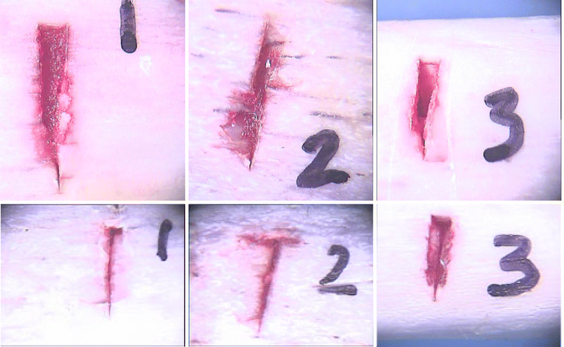 Differentiation of serrated and nonserrated blades from stab marks in