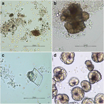 springernature causes urolithiasis