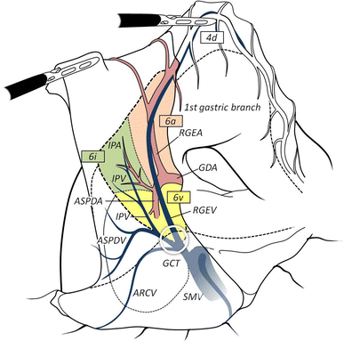Topographic anatomy and laparoscopic technique for dissection of no. 6