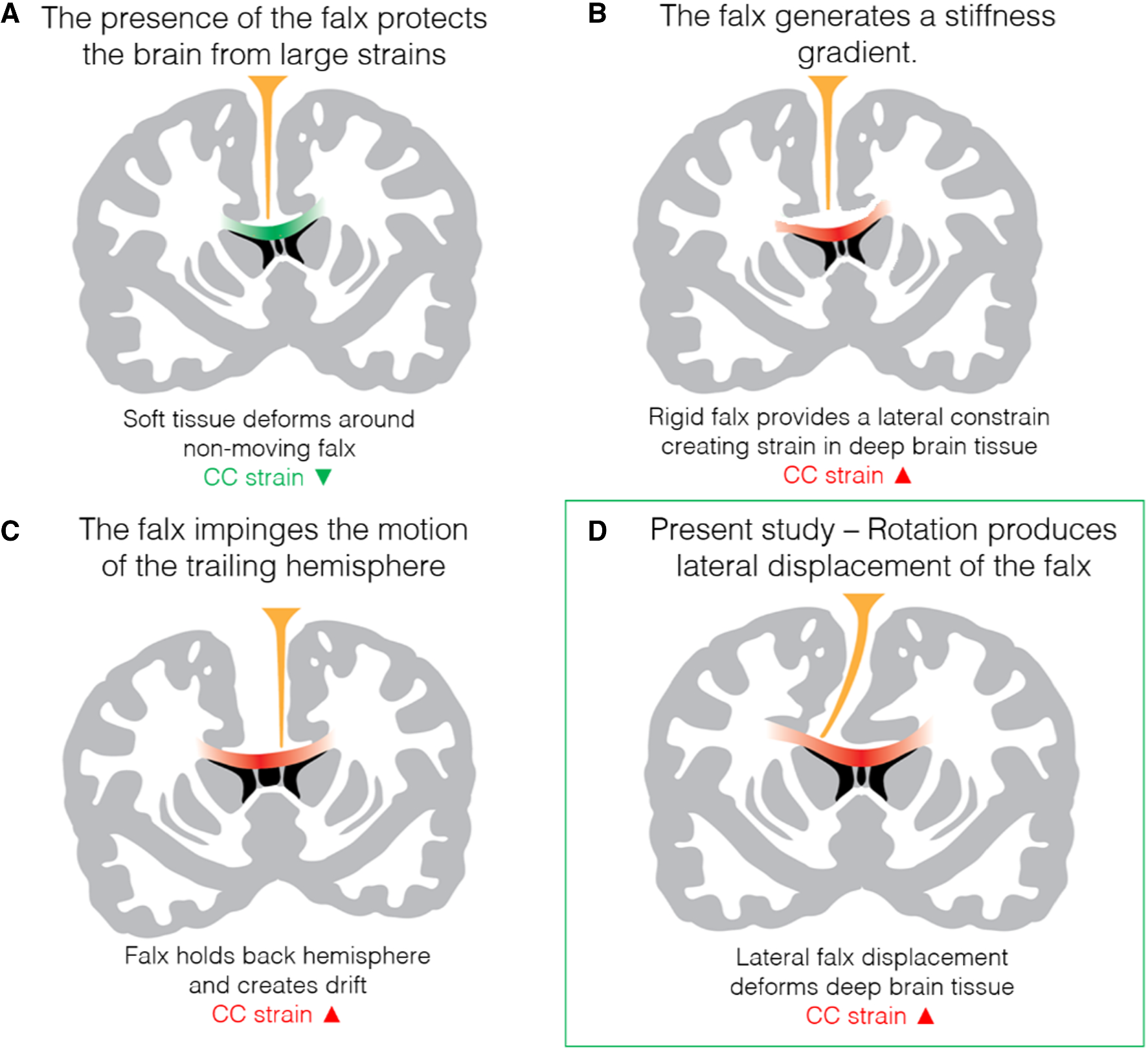 Lateral impacts correlate with falx cerebri displacement and corpus ...