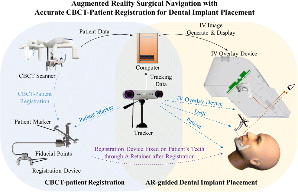 Augmented reality surgical navigation with accurate CBCTpatient