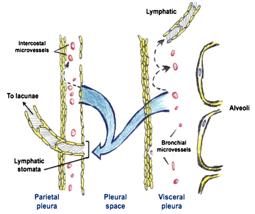 Interventional Pulmonologist Perspective: Treatment of Malignant