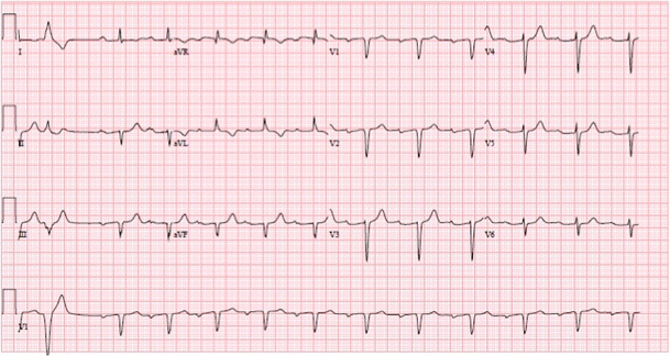 Congenital Heart Disease in the Adult: What Should the Adult ...