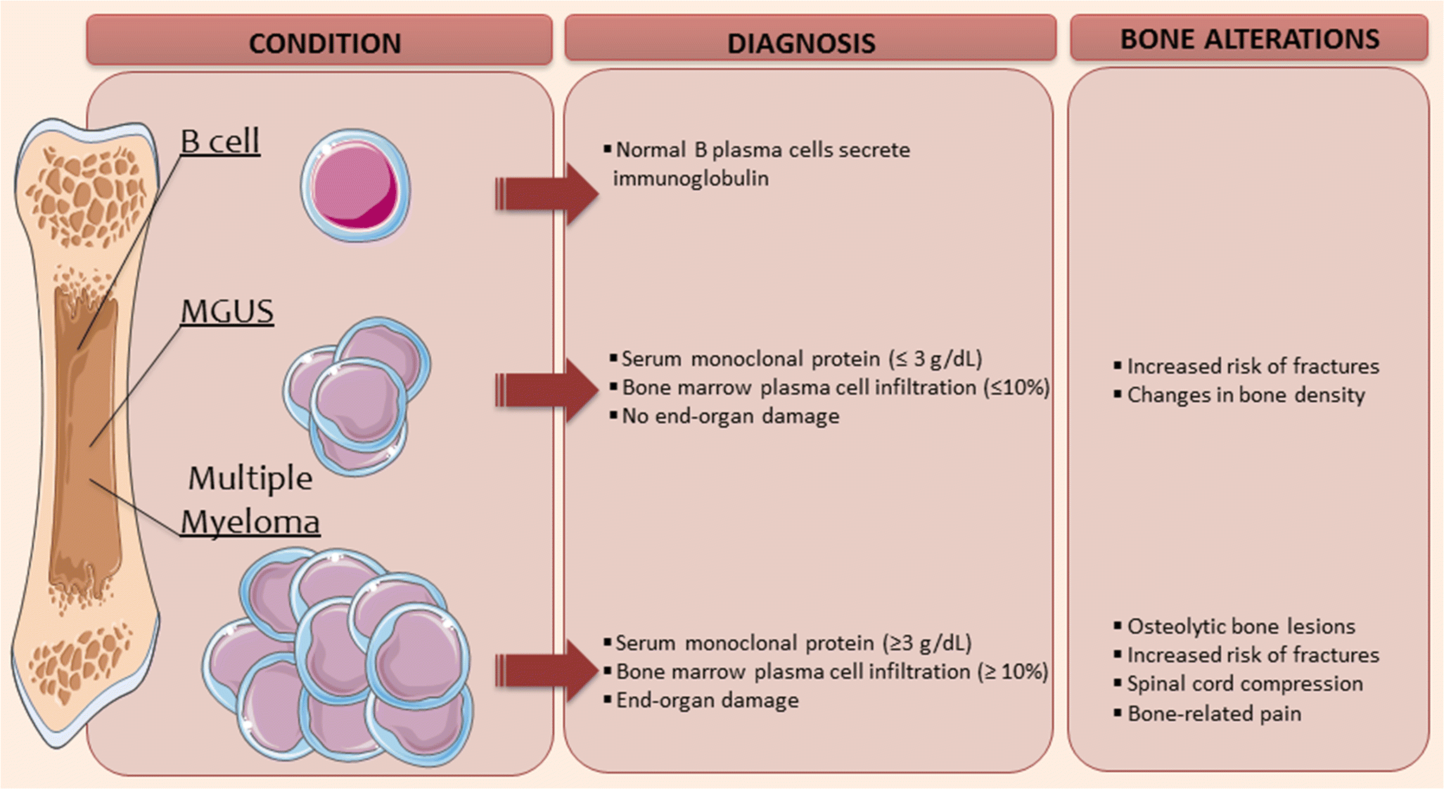 Contributions of the Bone Microenvironment to Monoclonal Gammopathy of