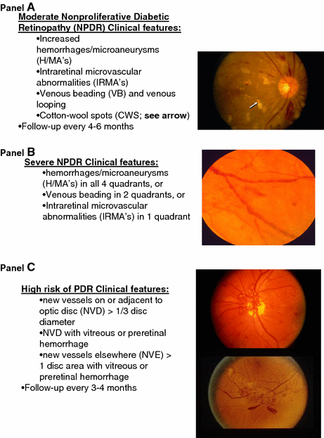 How the diabetic eye loses vision | SpringerLink