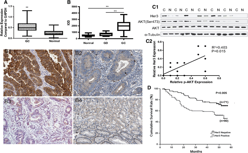 Her3 is associated with poor survival of gastric adenocarcinoma: Her3 ...