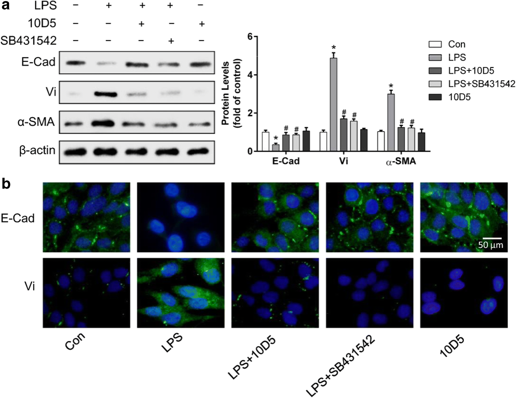 Integrin αvβ6 mediates epithelial-mesenchymal transition in human ...