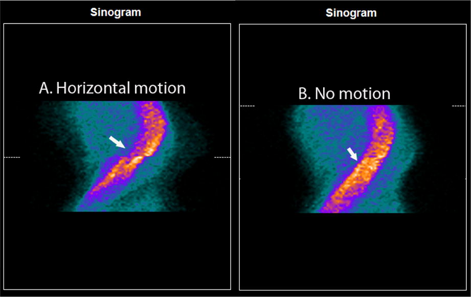 cellprofiler motion correction cellprofiler motion correction