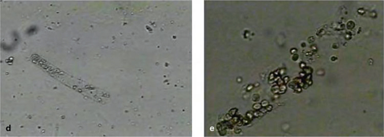 Urineafwijkingen en elektrolytstoornissen | SpringerLink