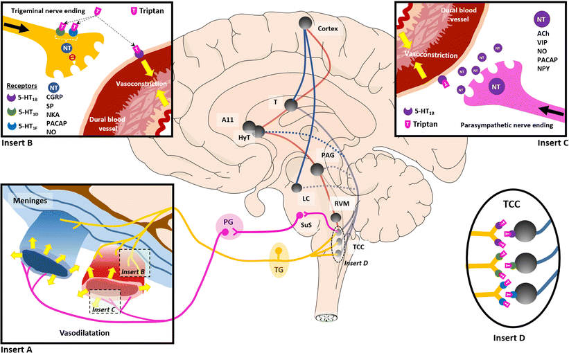 Migraine Treatment Current Acute Medications and Their Potential Mechanisms of Action
