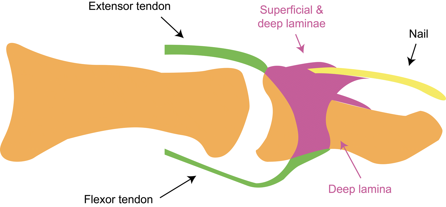 Enthesitis locations picture
