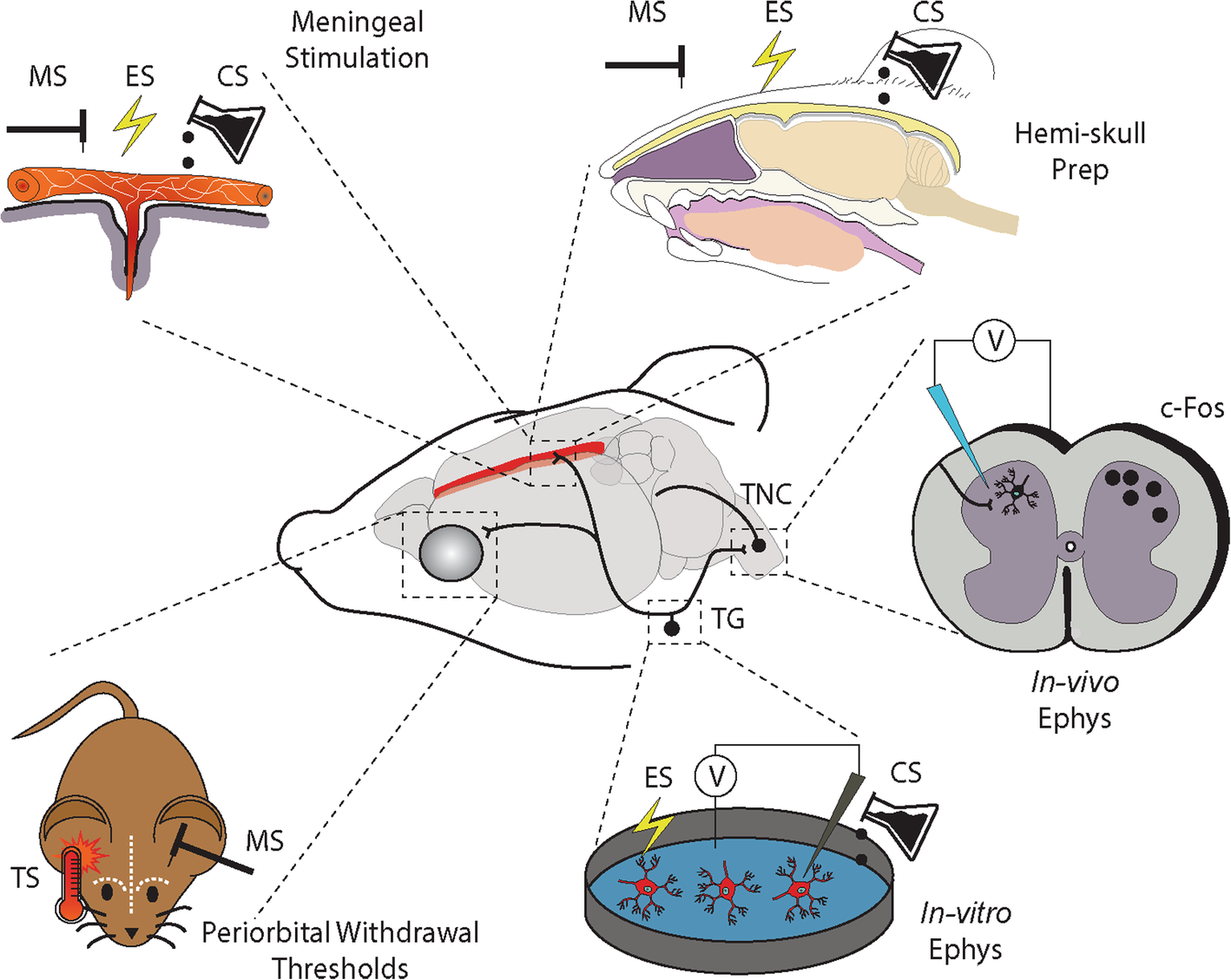 Animal models of migraine and experimental techniques used to examine