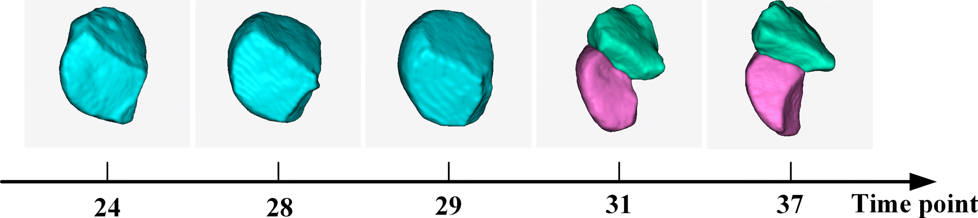 3dmms Robust 3d Membrane Morphological Segmentation Of C