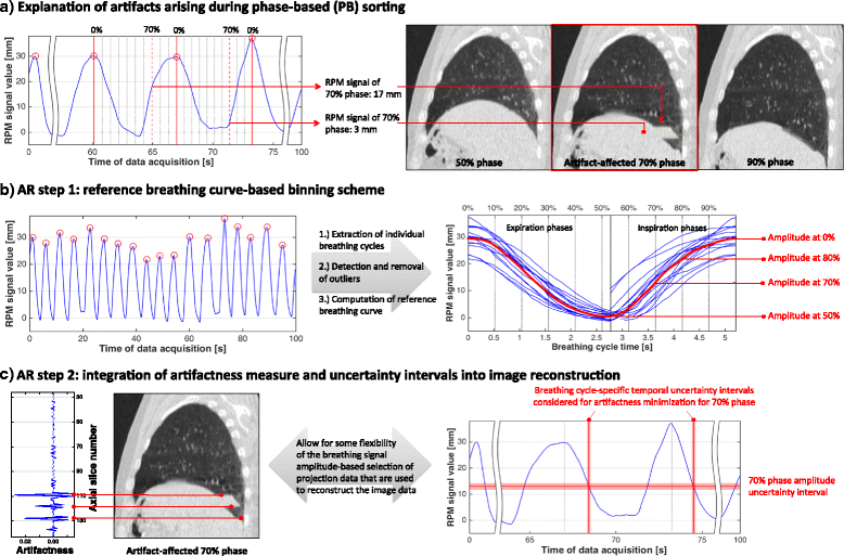 Reduction of breathing irregularityrelated motion artifacts in low