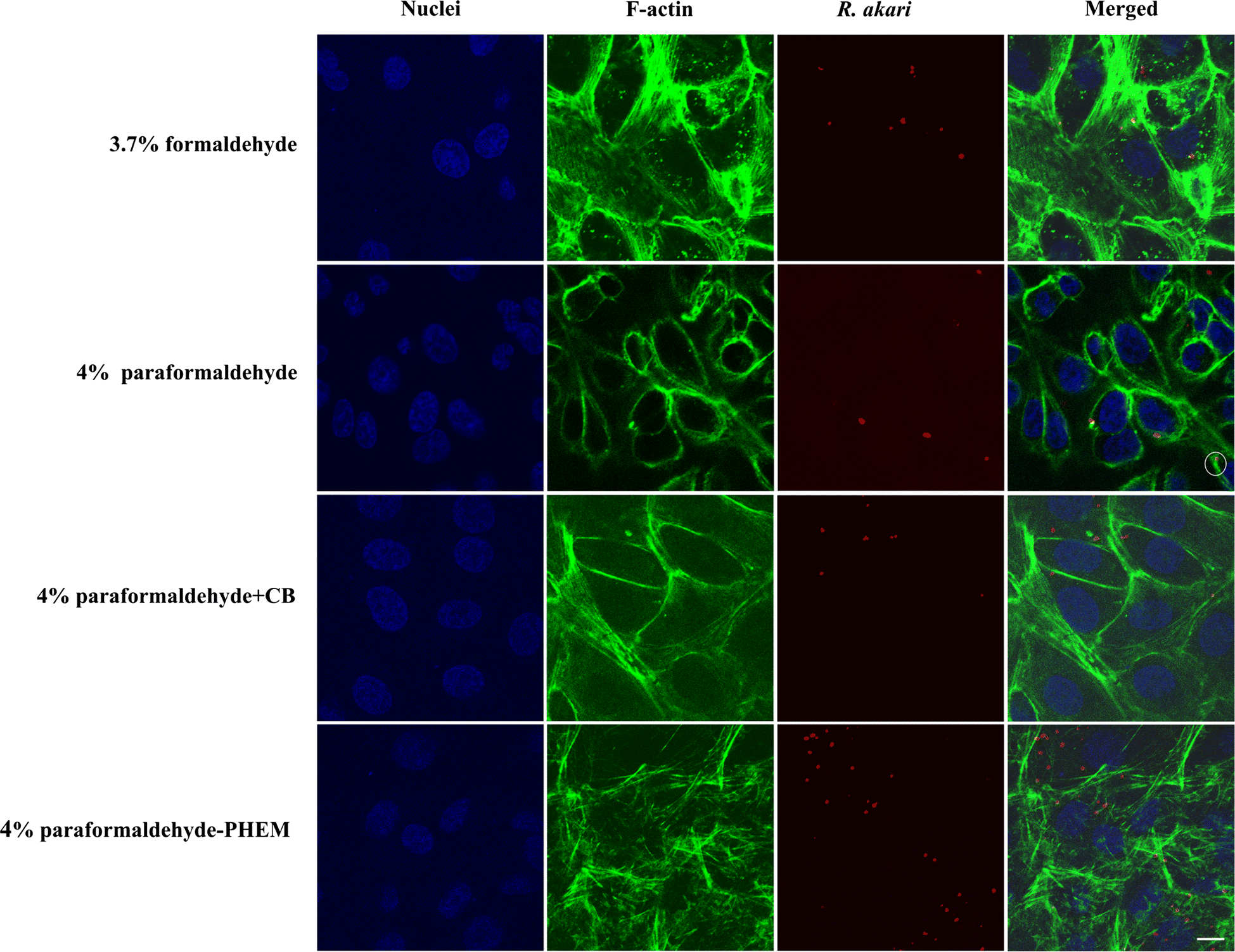 Optimized fixation of actin filaments for improved indirect