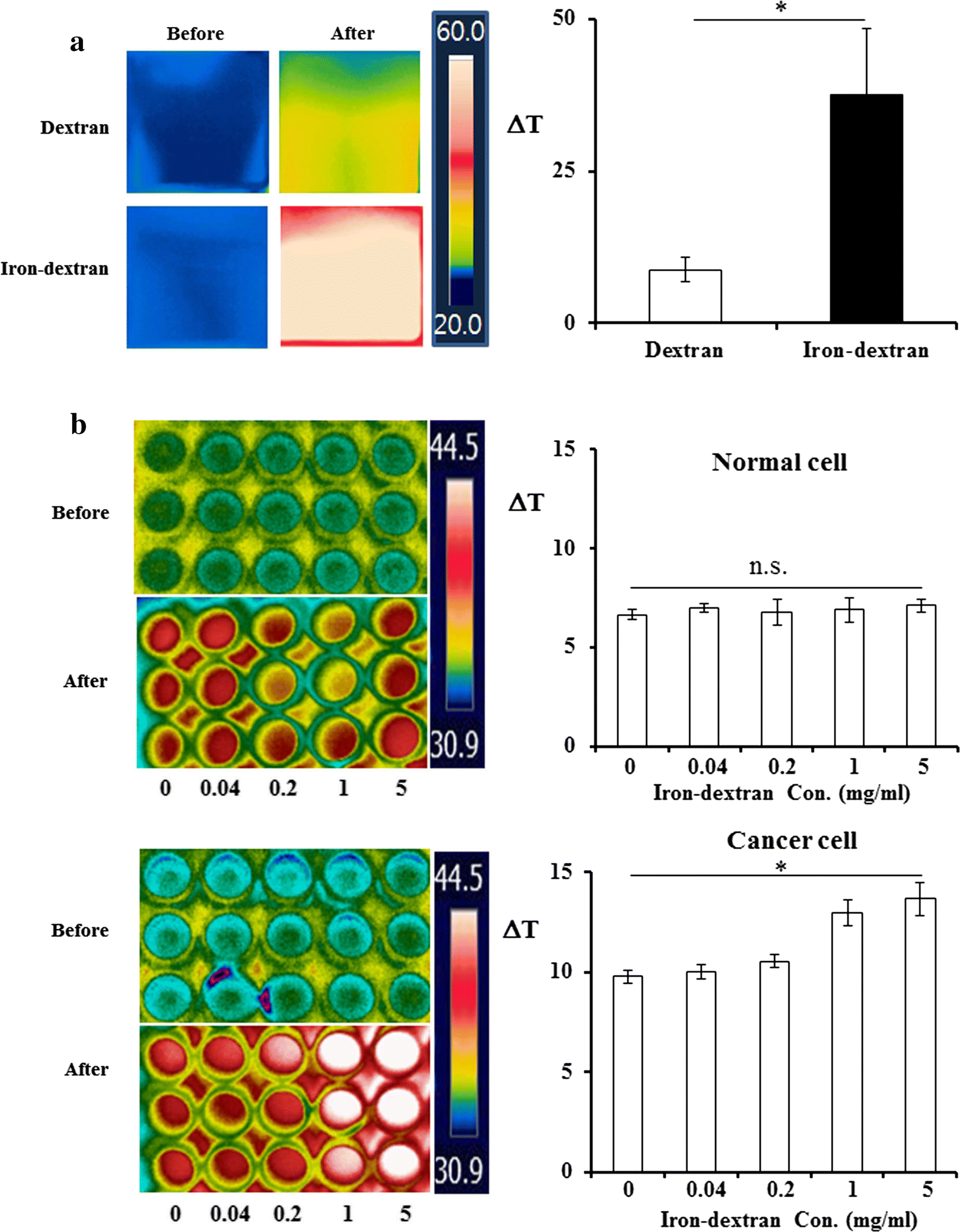 Irondextran as a thermosensitizer in radiofrequency hyperthermia for
