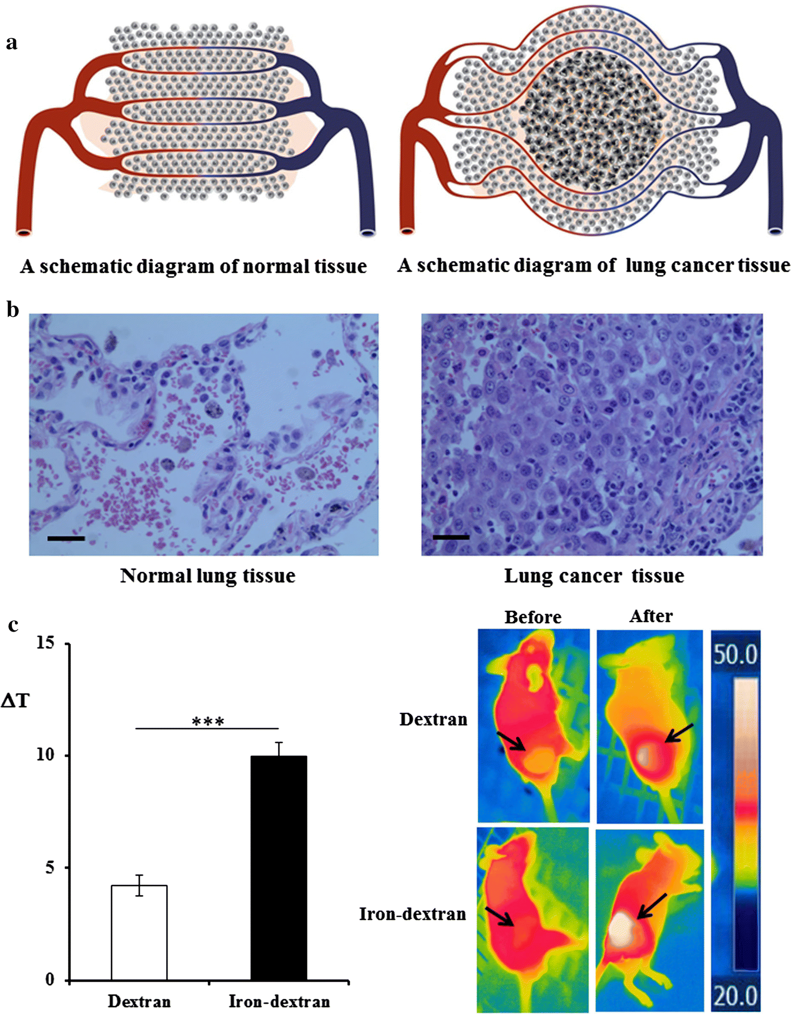 Irondextran as a thermosensitizer in radiofrequency hyperthermia for