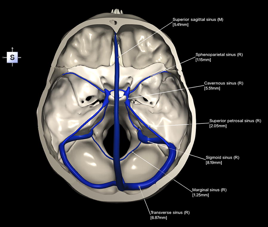 Skull Base Ct Anatomy