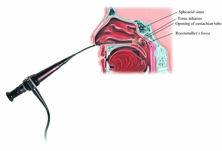Clinical and Endoscopic Examination of the Head and Neck SpringerLink